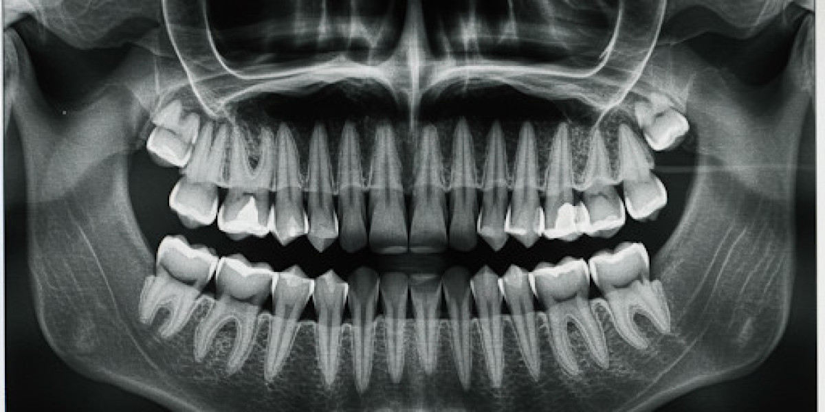 Technological Advancements in Dental Imaging: North America Market 2027