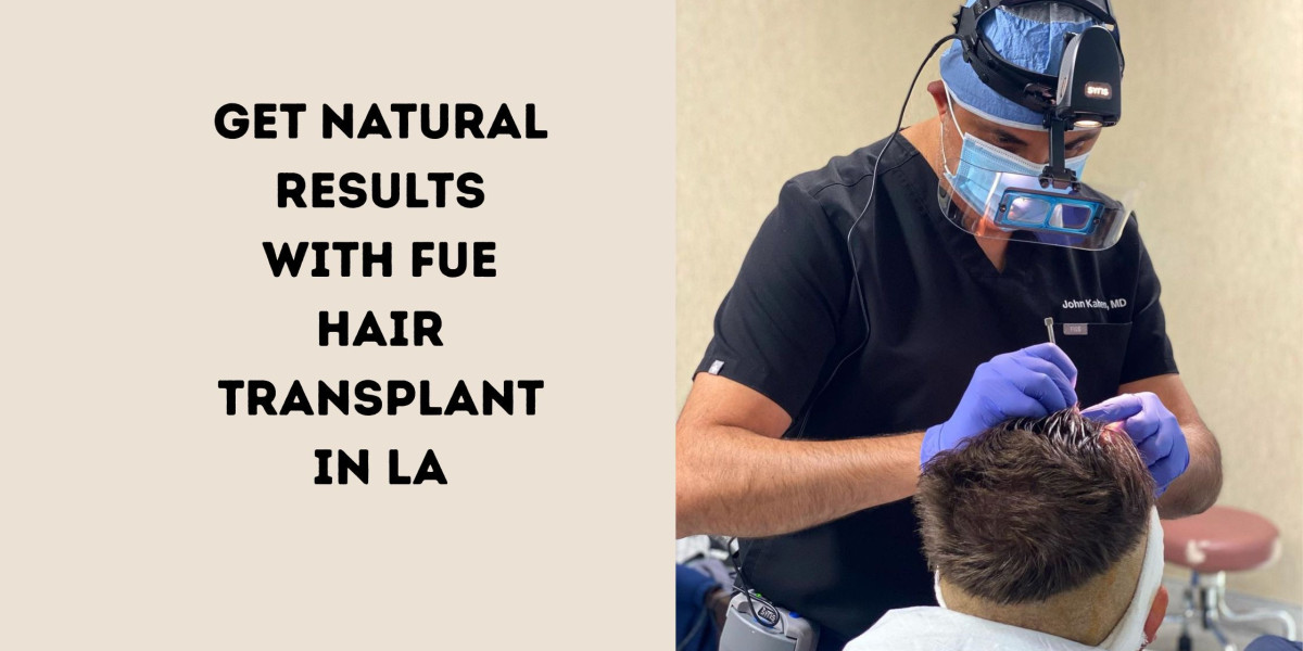 Get Natural Results with FUE Hair Transplant in LA