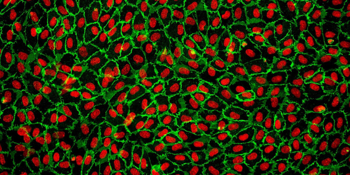 Primary Cells Market 2031: Analysis, Driving Factors, and Trends