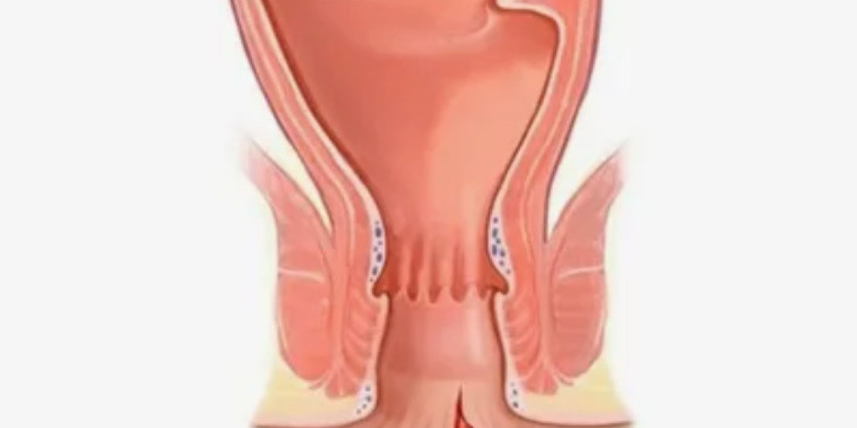 Anal Fissure Treatment Market Overview, Growth, and Forecast by 2031