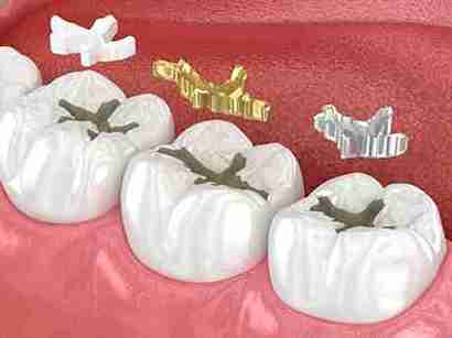 Image Source - Emergency Dentist Sheffield