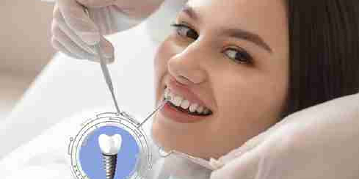The Role of Guided Surgery in Precision Implant Placement