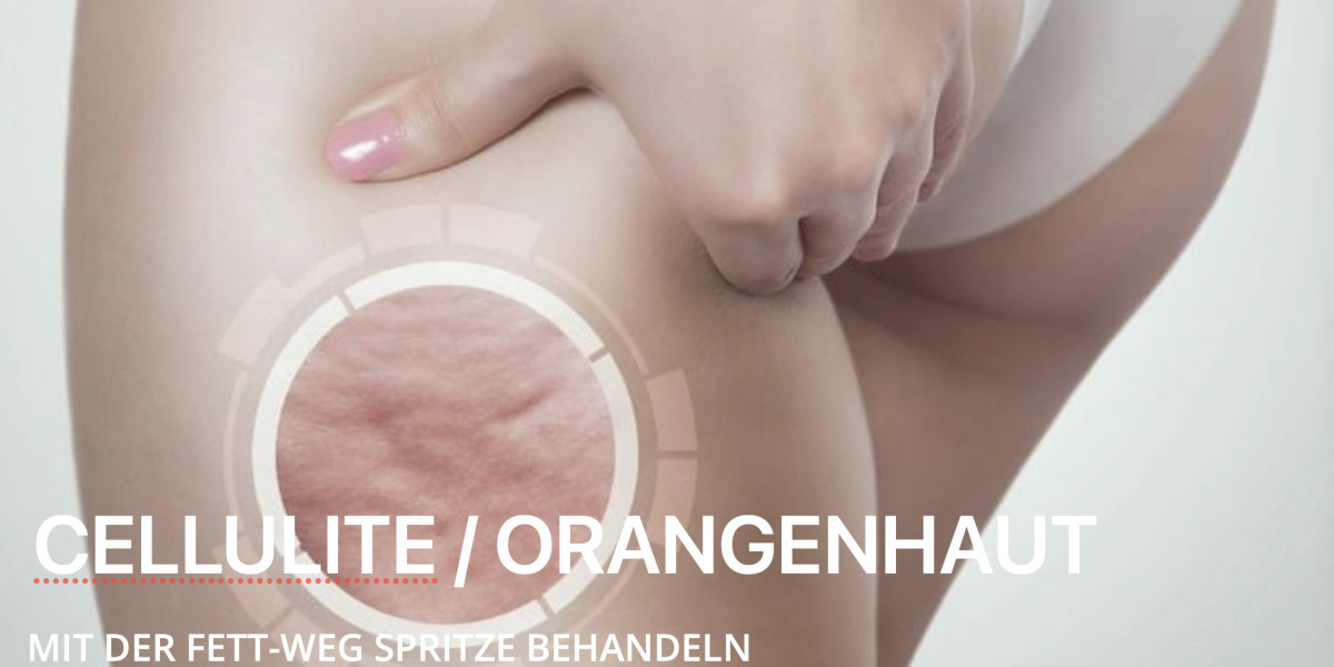 Fettwegspritze Zürich – was steckt dahinter?